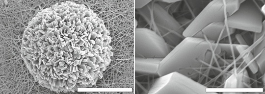 Surface micrographs of a TeMs + Chitosan + Ni-MOF sample at various magnifications