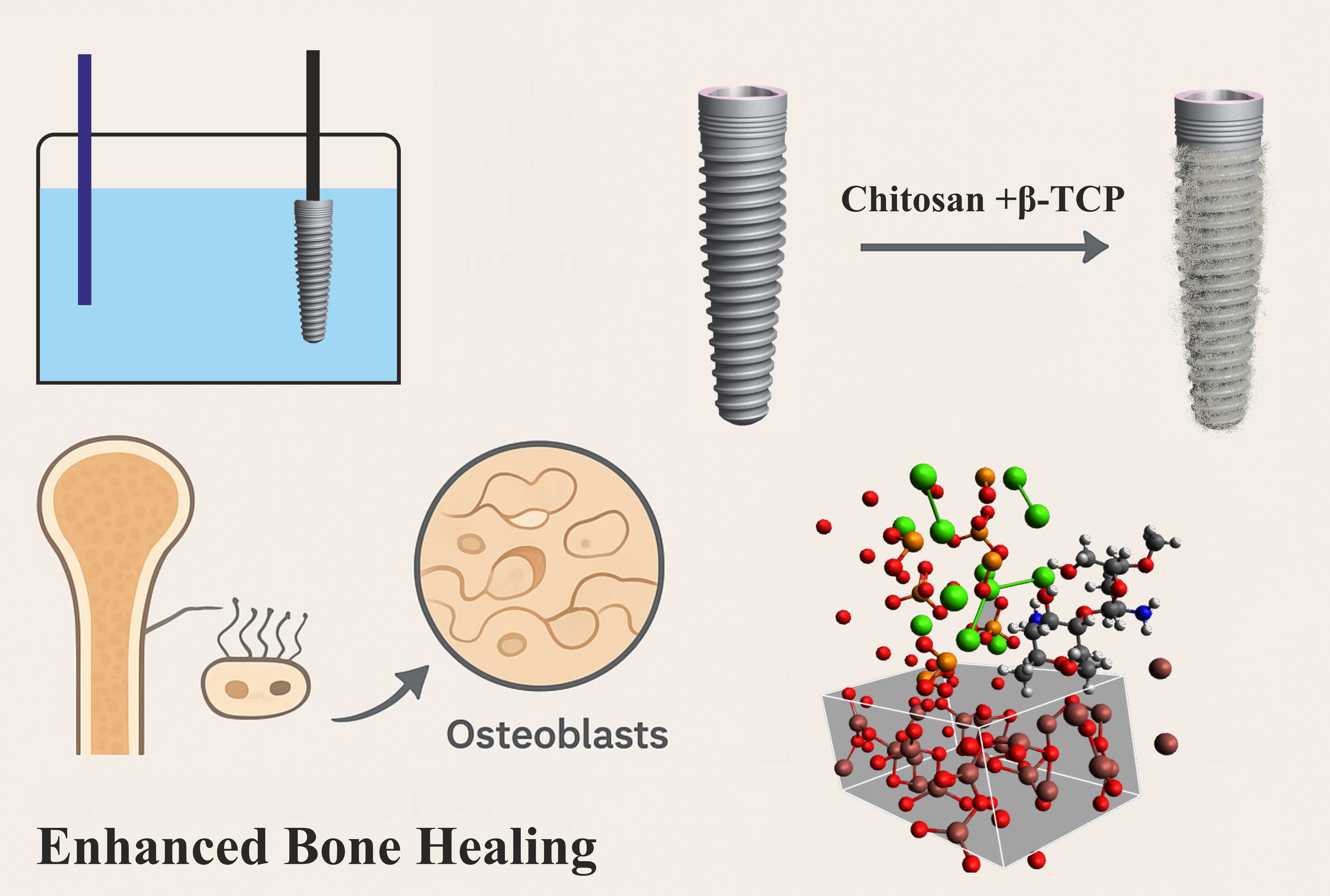 Bioactive Chitosan/β-Tricalcium Phosphate Coatings on Titanium: Experimental Optimization and DFT Insight